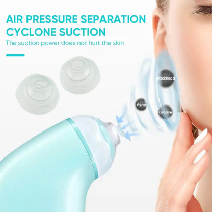 Vacuum Blackhead Remover – Mini Handheld Facial Tool – close-up