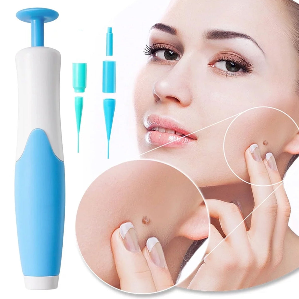 Skin Tag Remover Kit with Applicator and Bands – alternate view