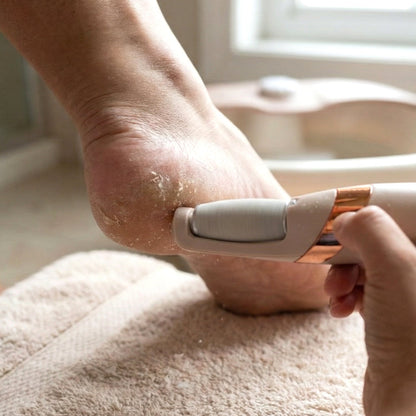 Electronic Pedicure Tool – Rechargeable & Cordless – close-up