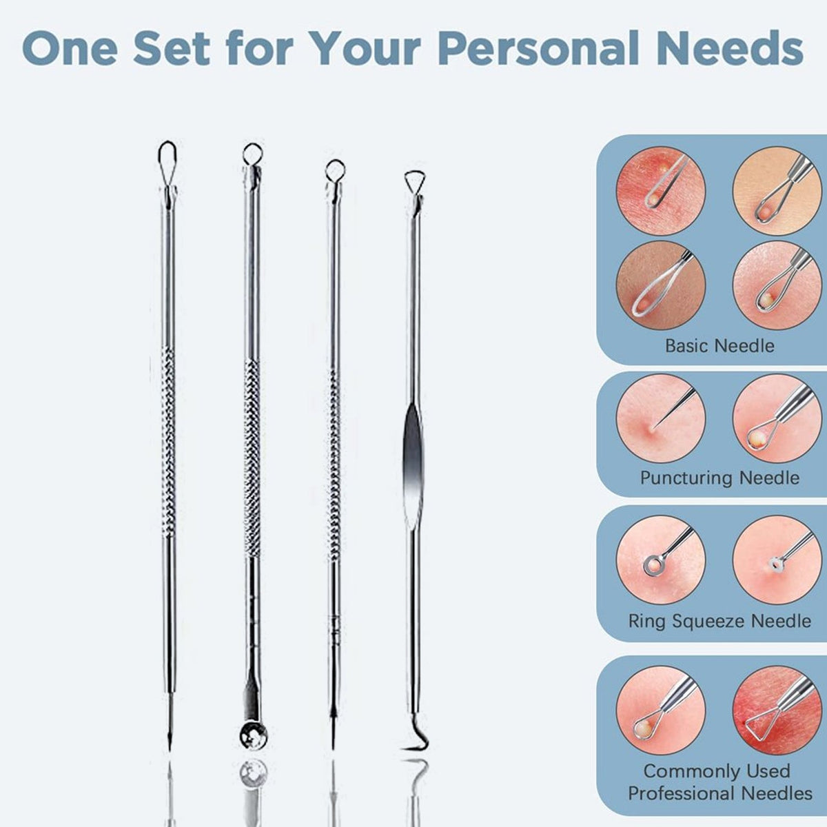 Blackhead Remover Tool – 4-in-1 Stainless Steel Extractor – detail view