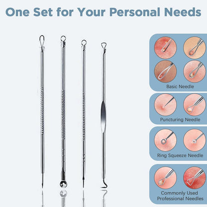 Blackhead Remover Tool – 4-in-1 Stainless Steel Extractor – detail view