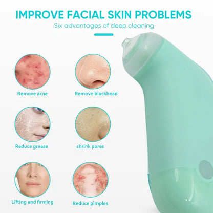 Vacuum Blackhead Remover – Mini Handheld Facial Tool – detail view