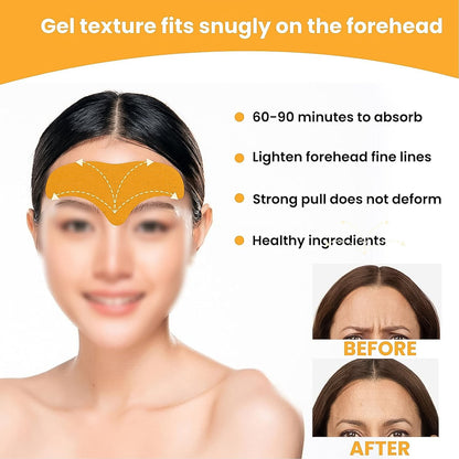 Forehead Wrinkle Patches (10 Pcs) – Anti-Aging Pads – view 7