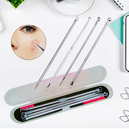 Blackhead Remover Tool – 4-in-1 Stainless Steel Extractor – close-up