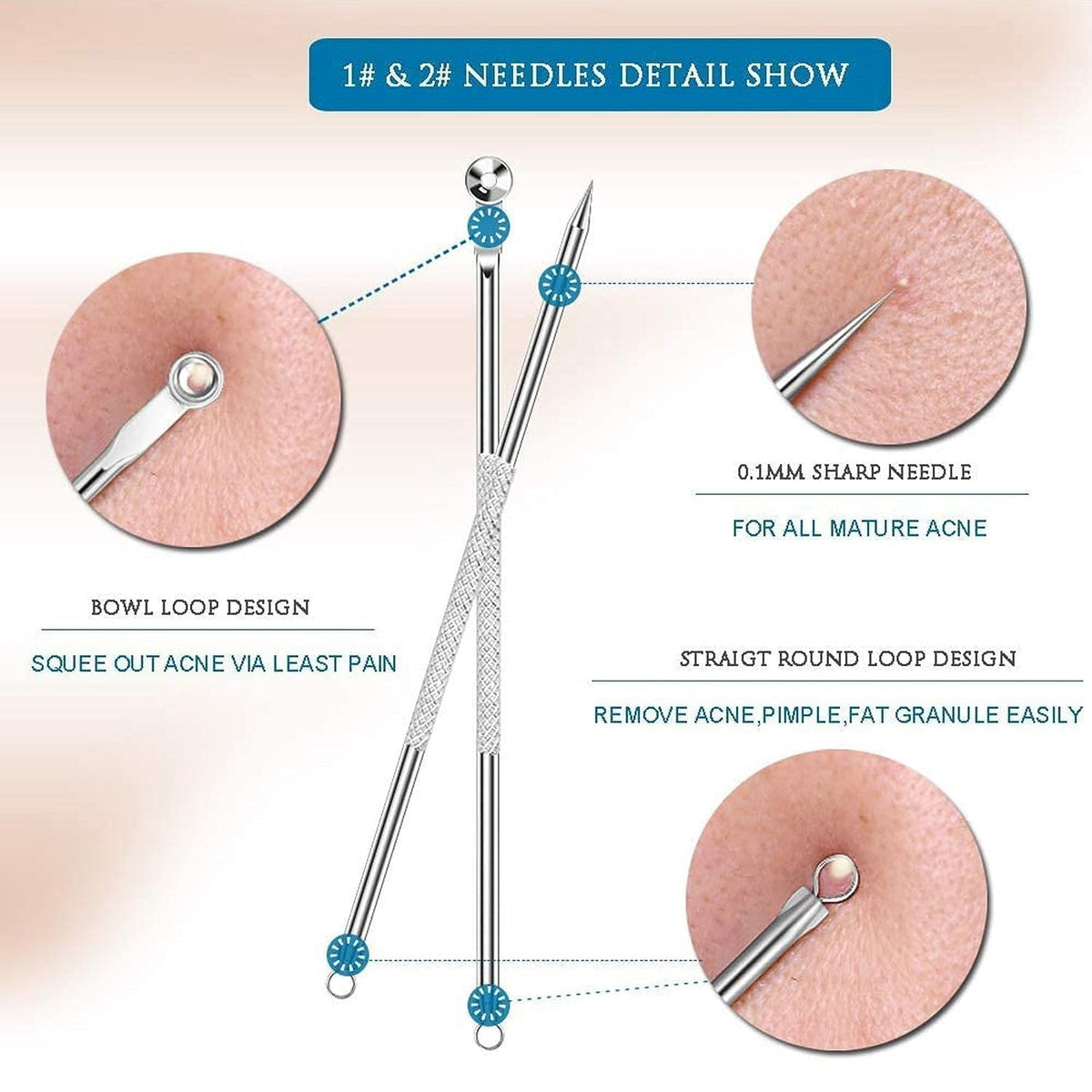 Blackhead Remover Tool – 4-in-1 Stainless Steel Extractor – view 6