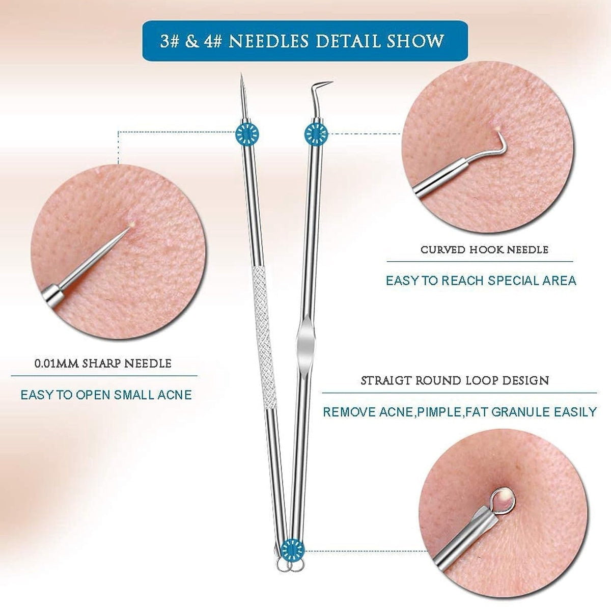 Blackhead Remover Tool – 4-in-1 Stainless Steel Extractor – view 7