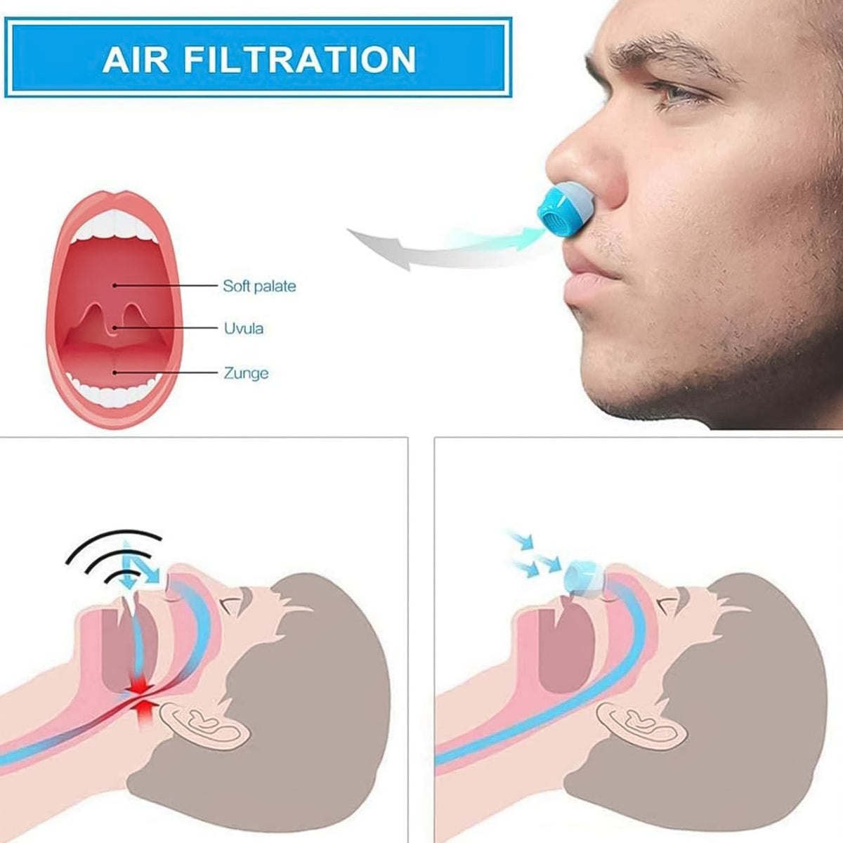 Anti-Snoring Nose Clip – 2-in-1 Air Purifier Device – close-up