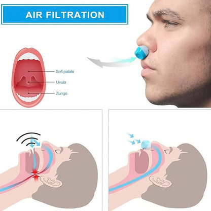 Anti-Snoring Nose Clip – 2-in-1 Air Purifier Device – close-up