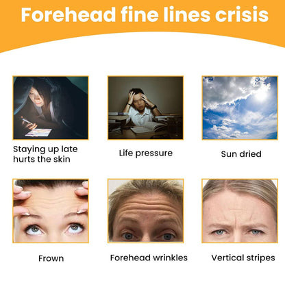 Forehead Wrinkle Patches (10 Pcs) – Anti-Aging Pads – close-up