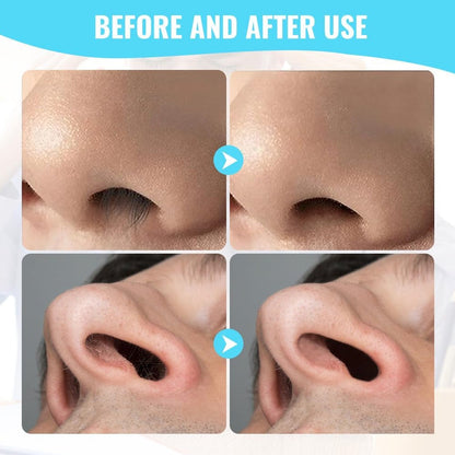 Nose Hair Trimmer – Painless 3-in-1 Grooming Kit – view 7