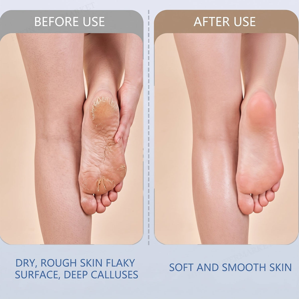 Electric Foot File – Rechargeable Callus Remover – view 7