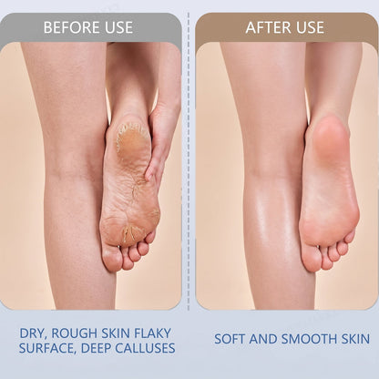 Electric Foot File – Rechargeable Callus Remover – view 7